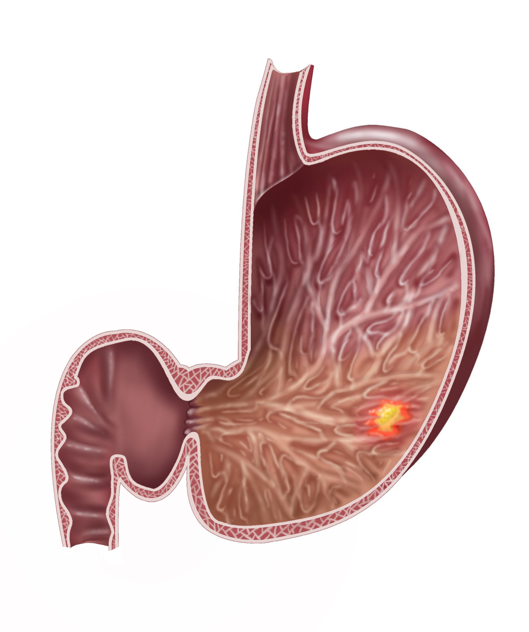 Gastroskopie Piotr Wrobel Facharzt für Innere Medizin